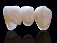 NhaKhoaThienBao-Aesthetic-Restoration-05