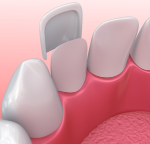 Nha-Khoa-Thien-Bao-Clinic-Picture-Stream-06