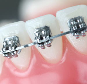 Nha-Khoa-Thien-Bao-Clinic-Picture-Stream-08