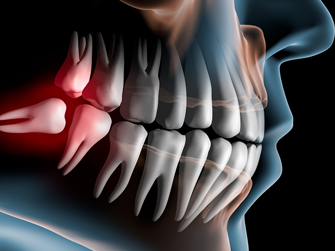 Nha-Khoa-Thien-Bao-oral-surgery-05-300x225